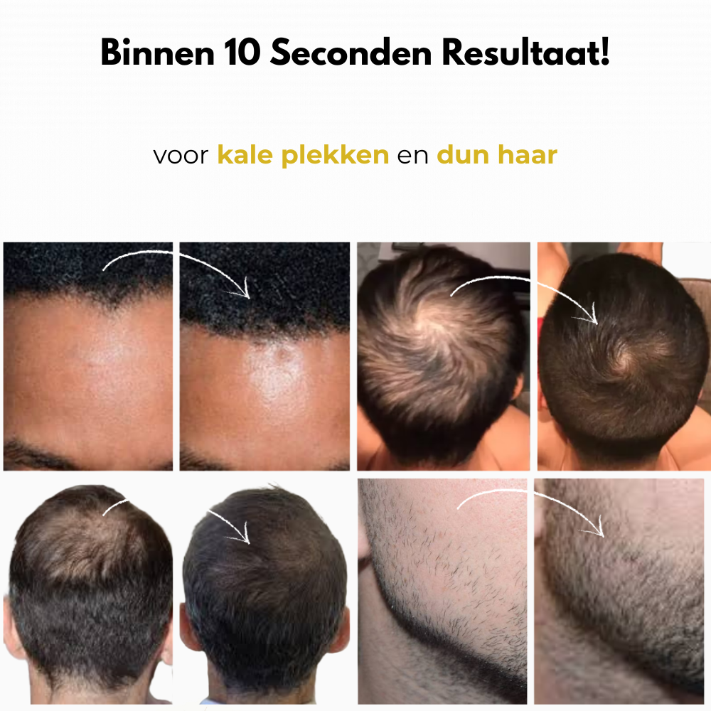 Nuvéo | Haarlijn Poeder